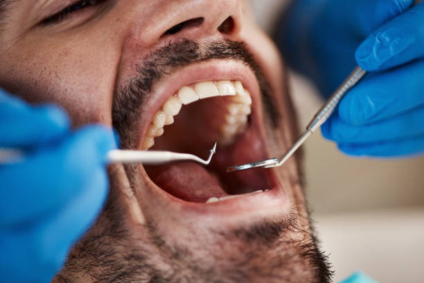 Best Cracked Tooth Emergency Dentist  in San Augustine, TX